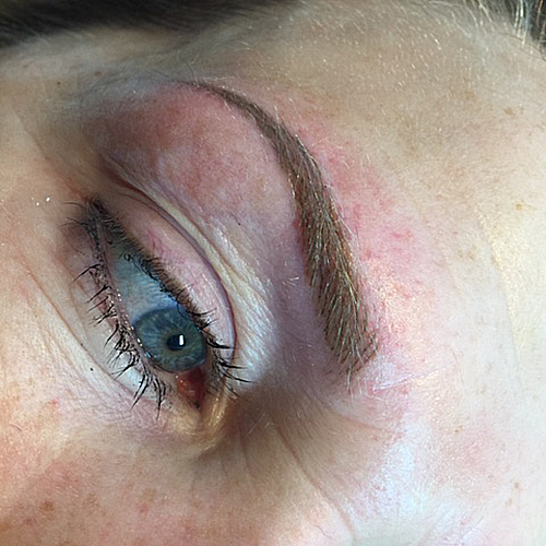 After brow nik