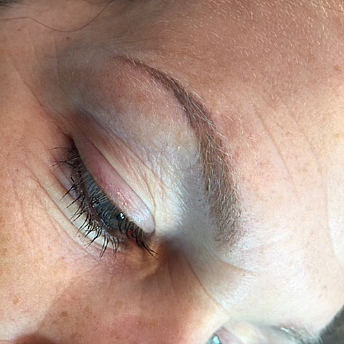 Healed brow nik