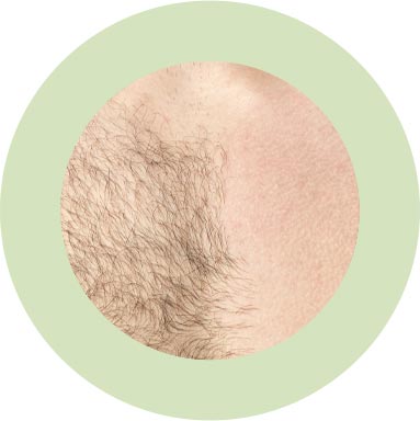 Mens Lycon Waxing Hair Removal Treatments
